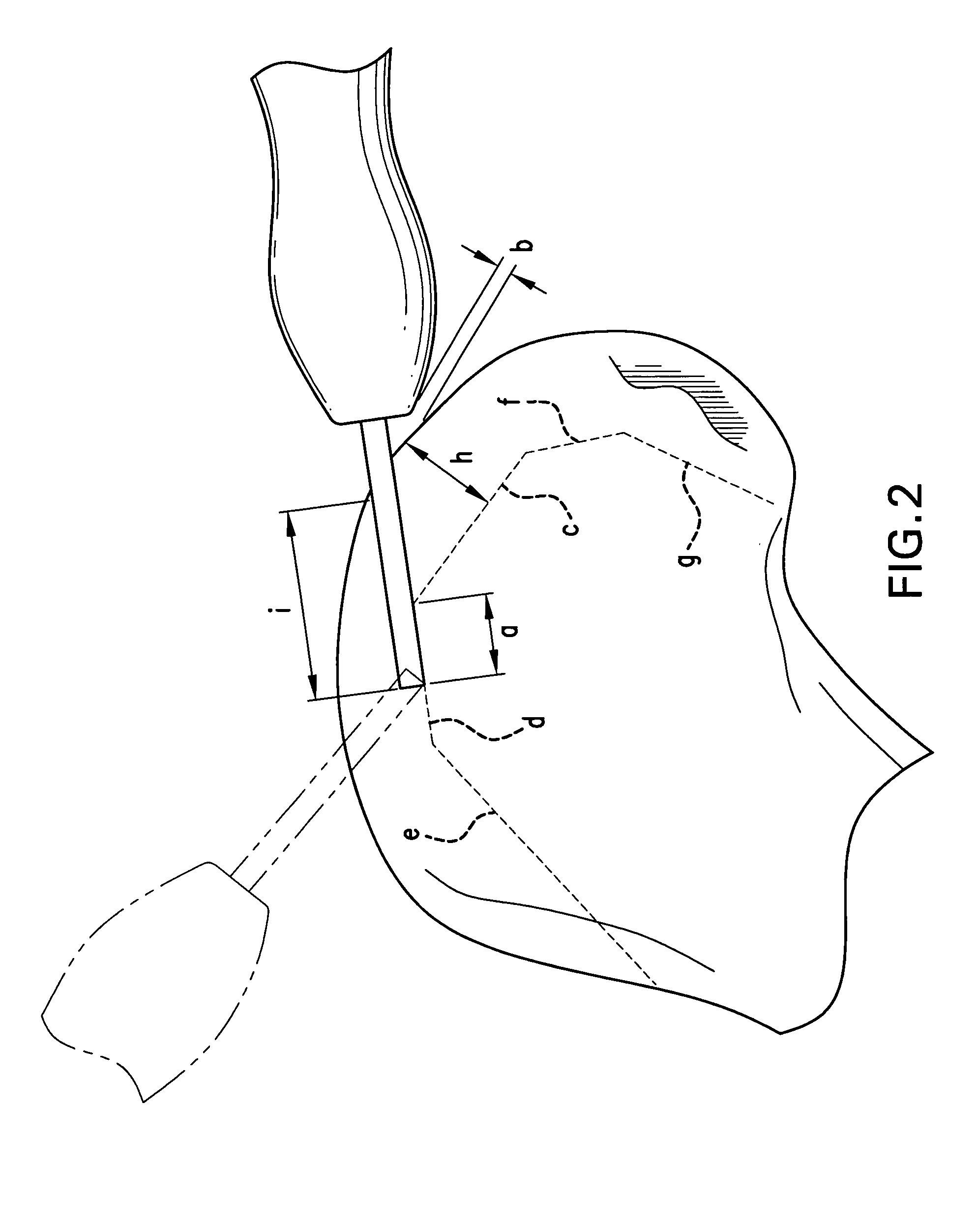 Method and system for cutting knee joint using robot