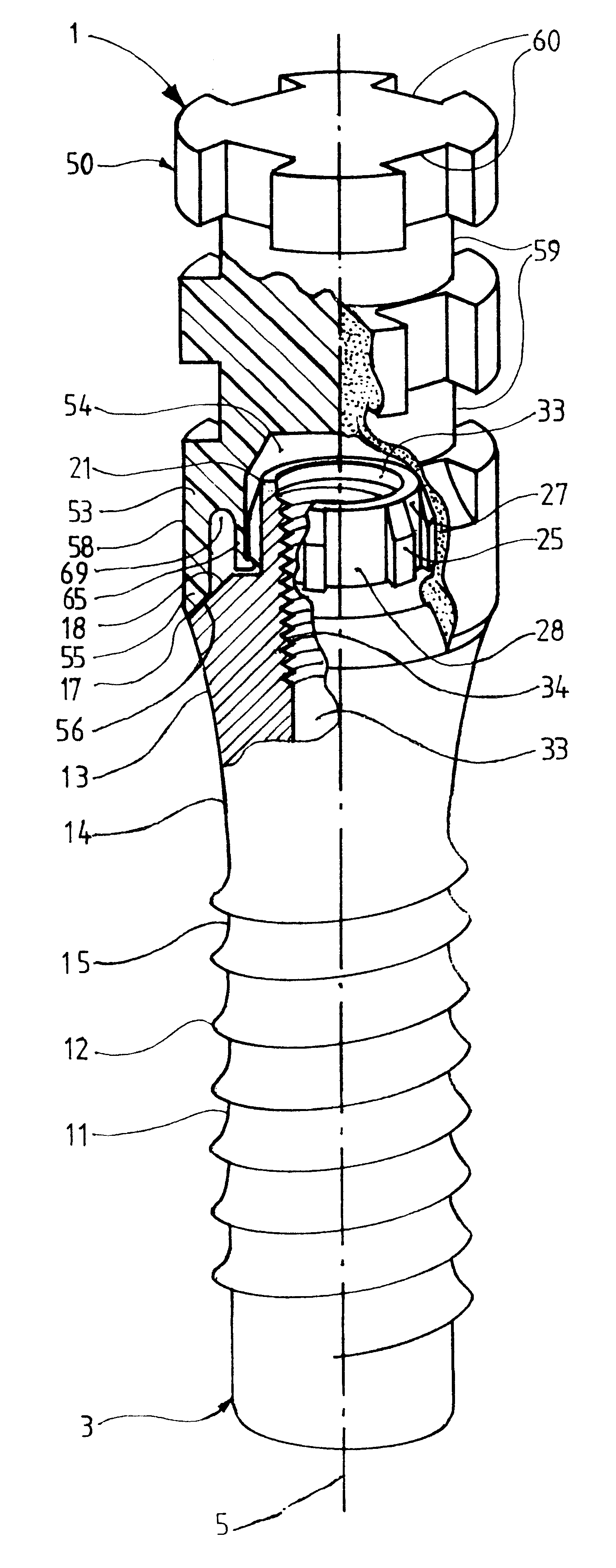 Device for forming a dental prosthesis
