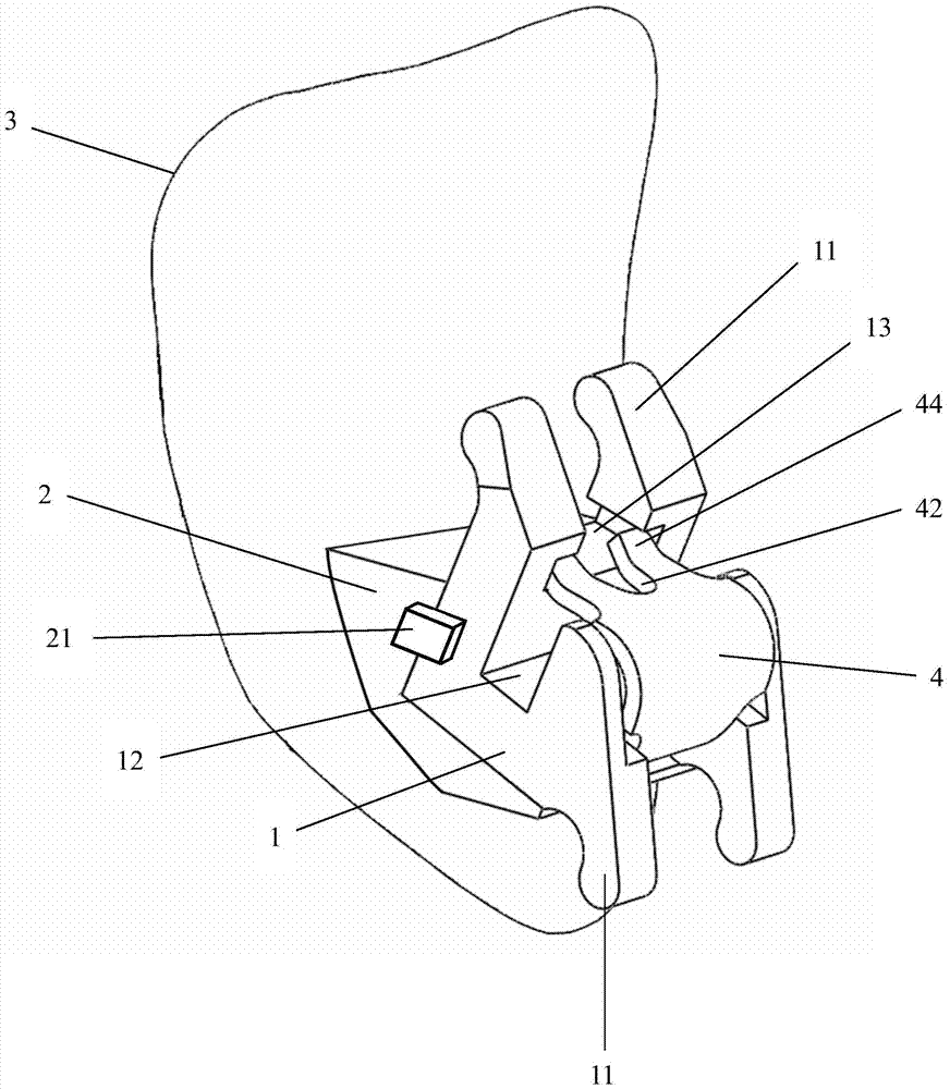 A manufacturing method of a personalized lingual straight wire arch self-locking bracket appliance