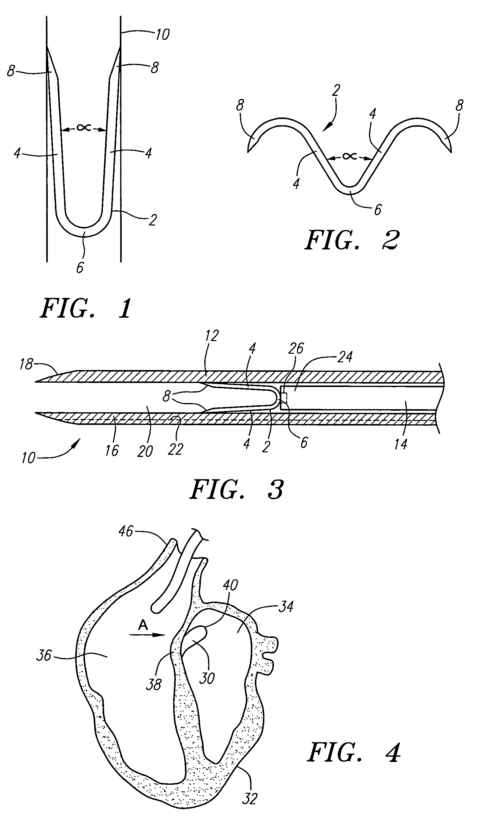 Clip apparatus for closing septal defects and methods of use