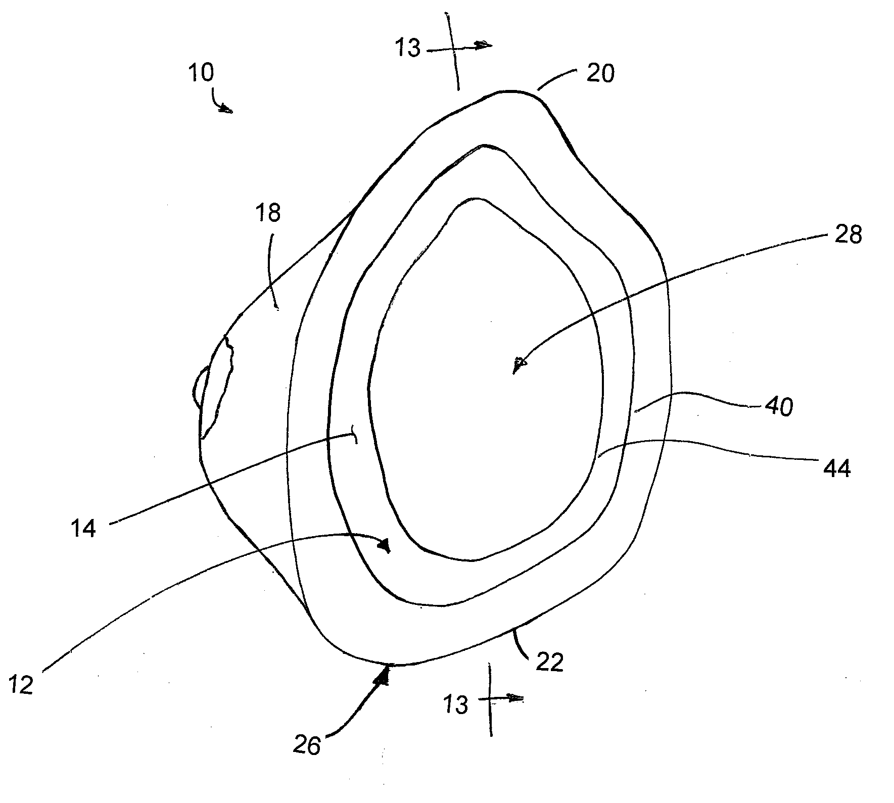 Method of Forming a Breast Prosthesis