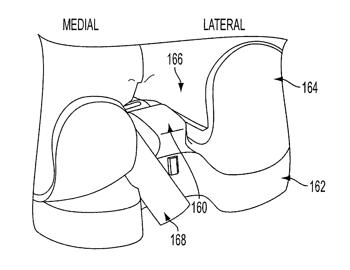 Methods and devices for knee joint replacement with anterior cruciate ligament substitution