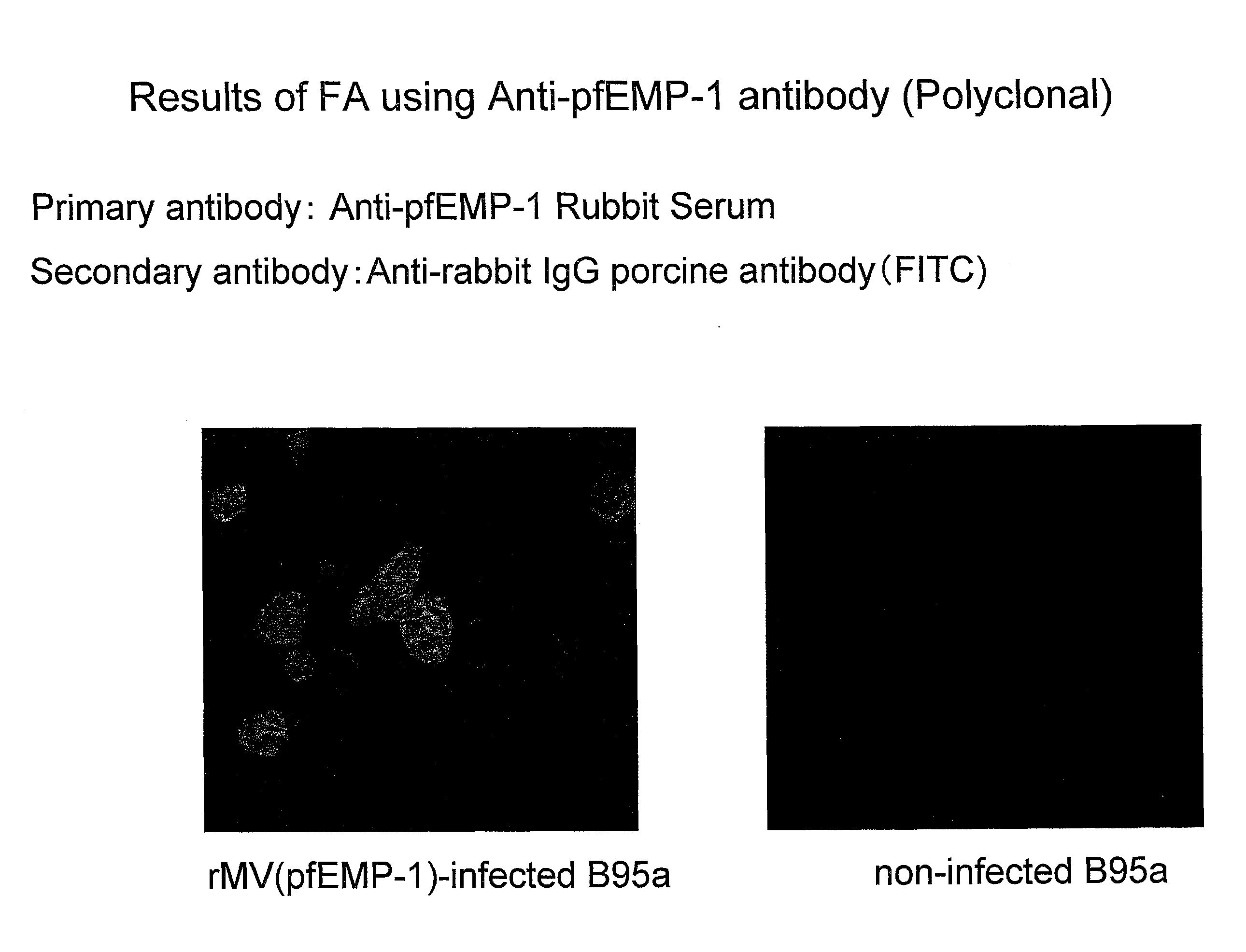 Recombinant Measles Virus Useful as a Bivalent Vaccine Against Measles and Malarial Infections