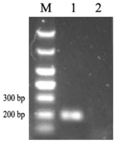 A detection primer and fluorescent quantitative PCR detection method for Acinetobacter lwwei
