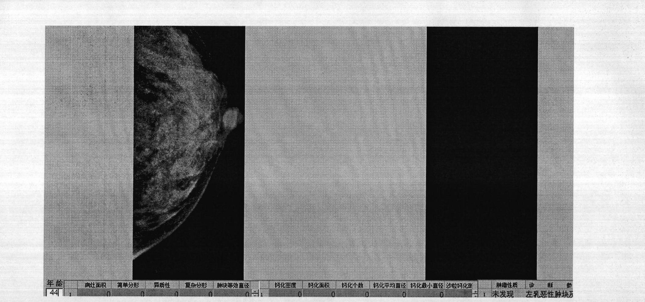 Breast mass and calcific benign-malignant automatic recognition and quantitative image evaluation system