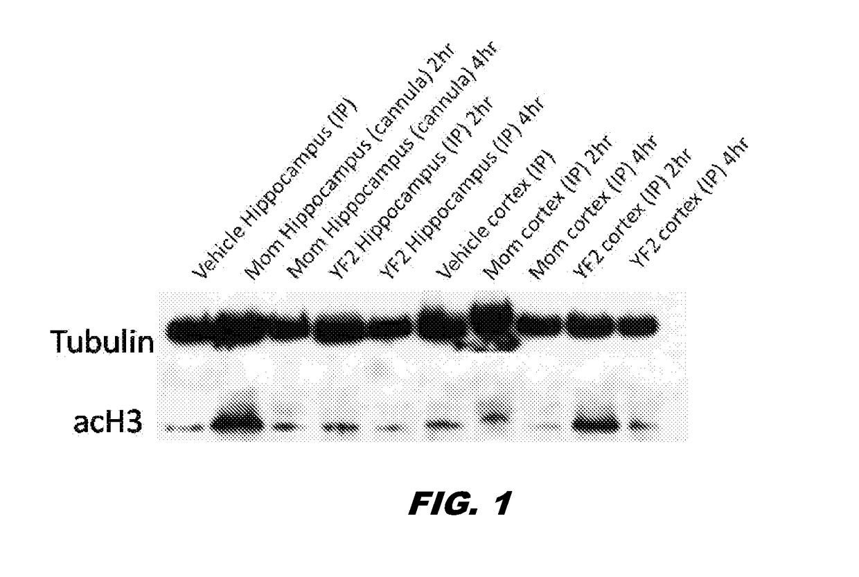Uses of histone acetyltransferase activators