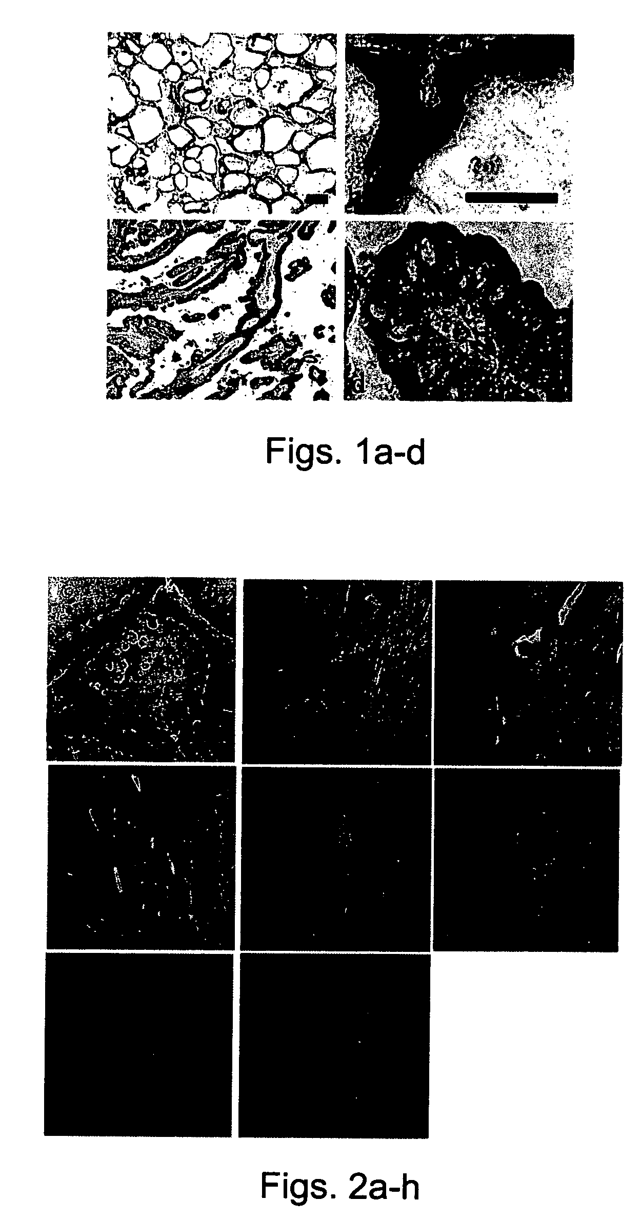 Human Sef isoforms and methods of using same for cancer gene therapy