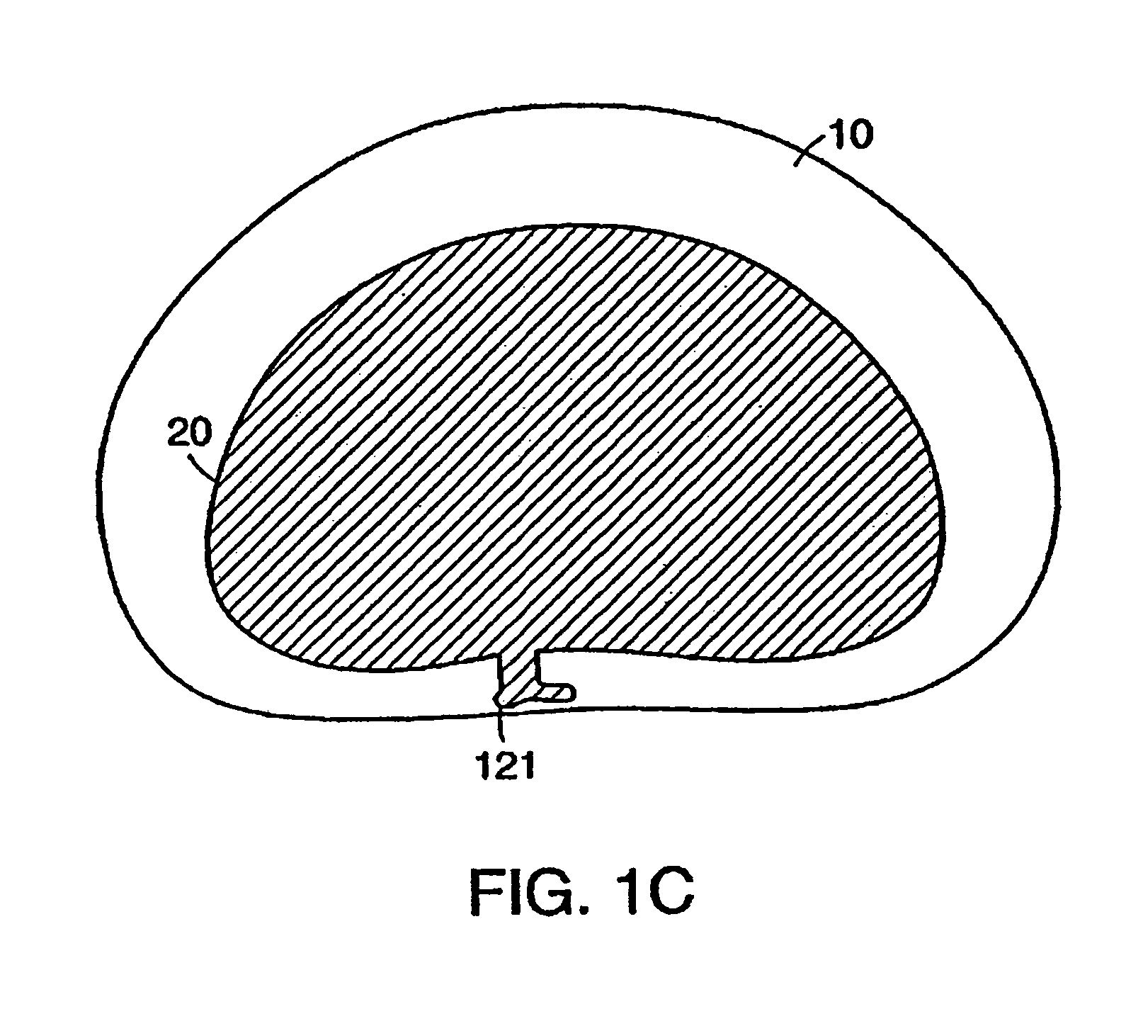 Stabilized intervertebral disc barrier