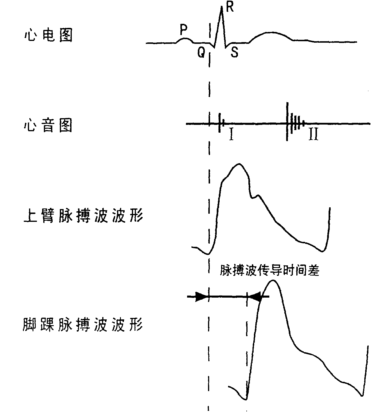 Pulse wave velocity computation method based on wavelet transform