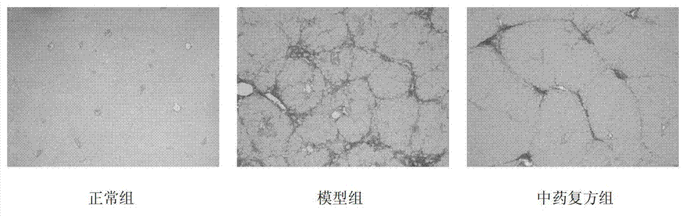 Traditional Chinese medicine compound composition for treating hepatopathy and application thereof
