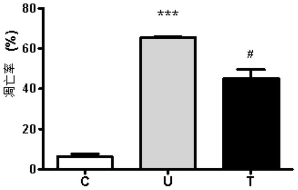 Application of umbelliferone in preparing composition for resisting skin photoaging