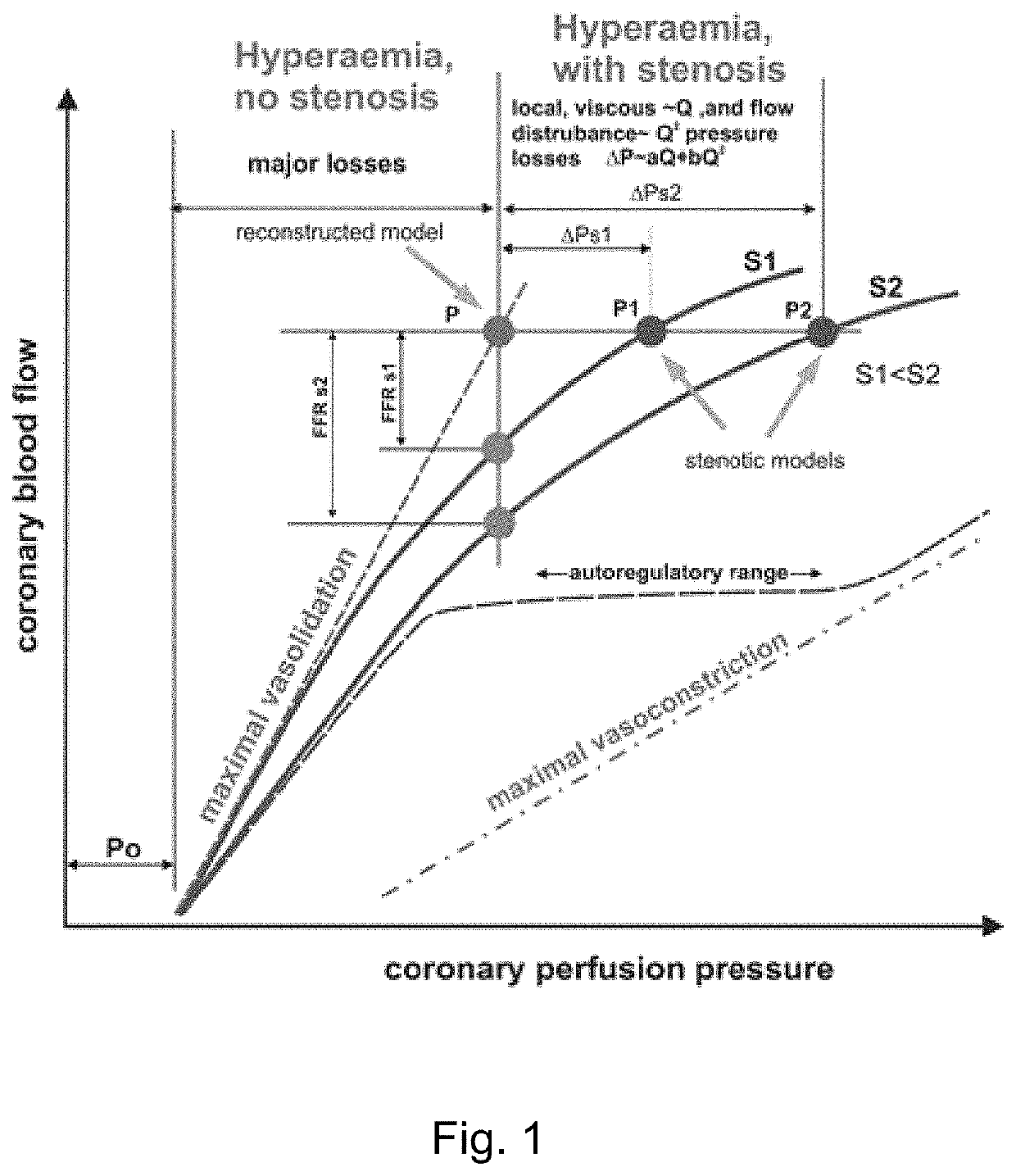 Method and system for modelling blood vessels and blood flow under high-intensity physical exercise conditions