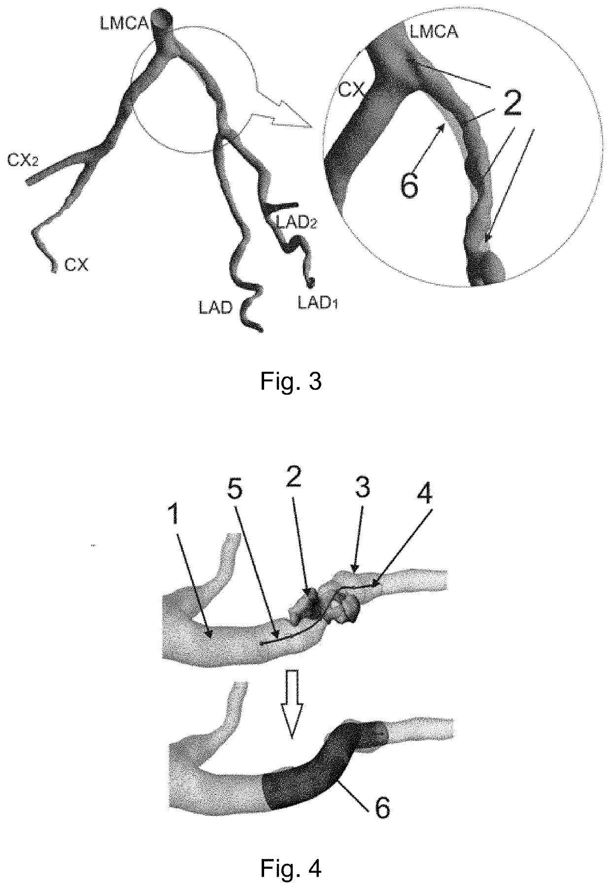 Method and system for modelling blood vessels and blood flow under high-intensity physical exercise conditions