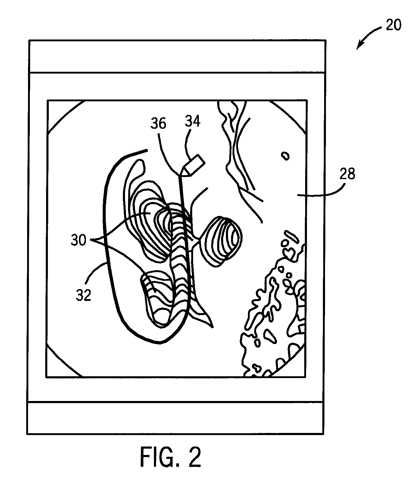 Ablation array having independently activated ablation elements