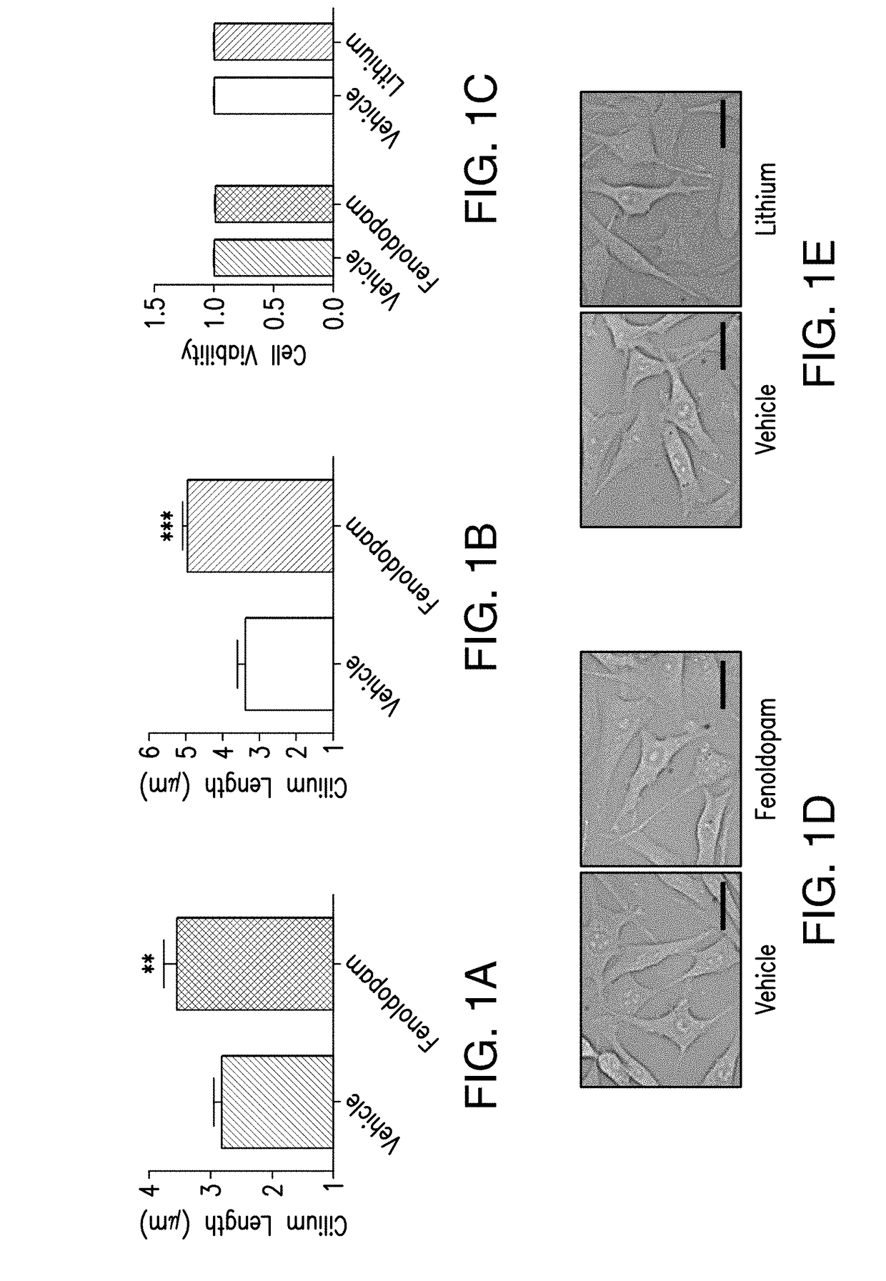 Regulation of gene expression by modulating primary cilia length