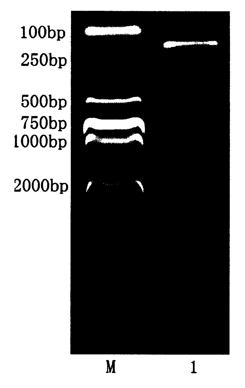 Method for detecting giardia by pyrosequencing technology