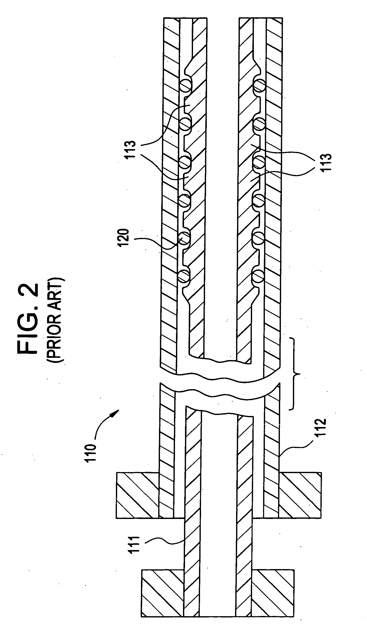 Deployment system for an intraluminal medical device
