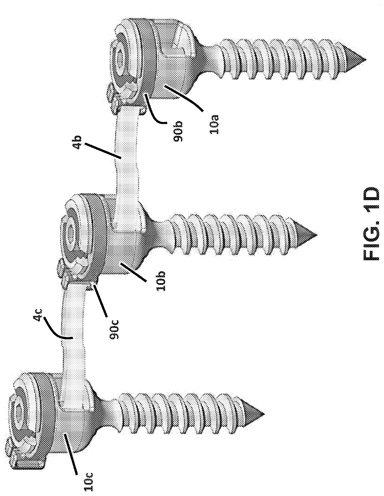 Apparatus and methods for spooled vertebral anchors