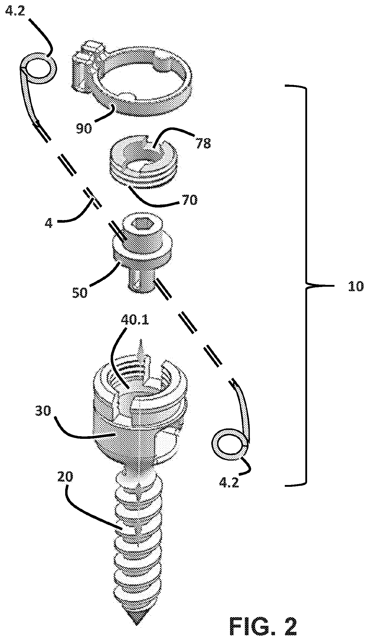 Apparatus and methods for spooled vertebral anchors