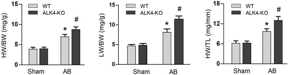 Functions and application of activin receptor-like kinase 4 in treatment of cardiac hypertrophy