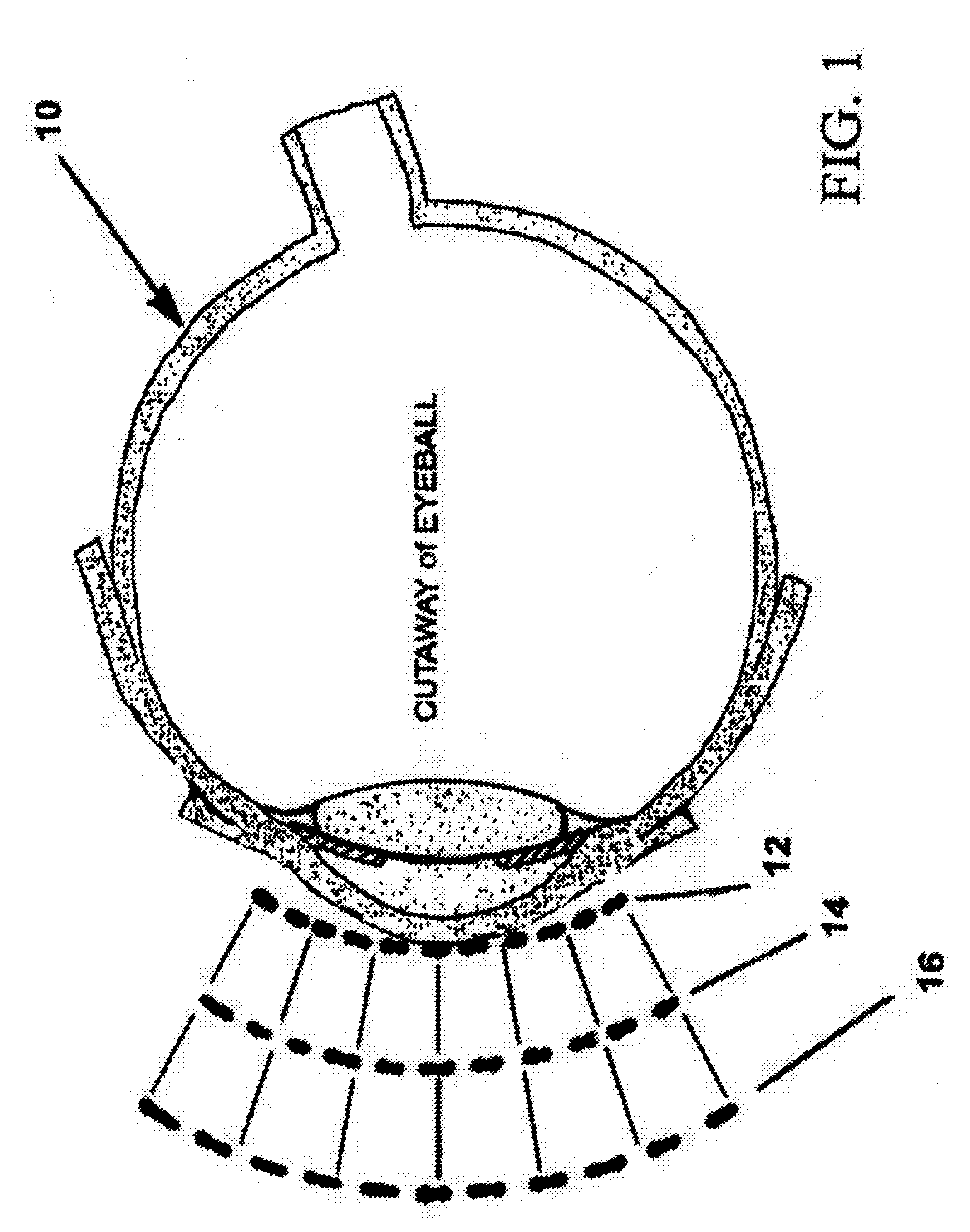 Toric-shaped lenses and goggle assembly