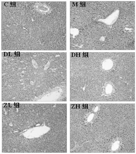 Astragalus mongholicus functional food for improving alcoholic liver injury