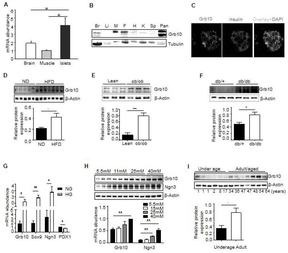 Grb10 used as key negative regulation factor of beta cell dysfunction