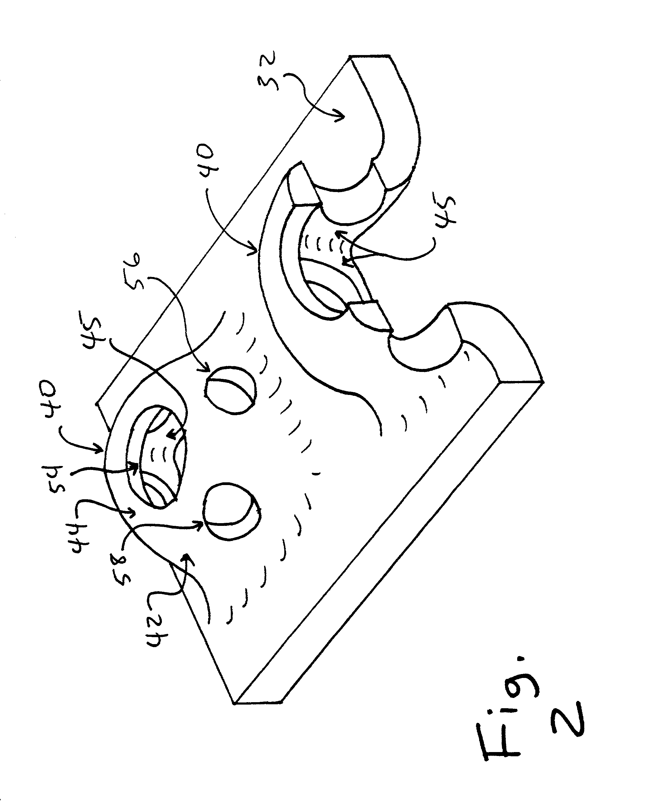 Cartilage repair implant with soft bearing surface and flexible anchoring device