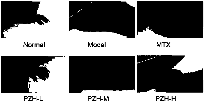 Application of Pianzaihuang for preparing medicine capable of treating rheumatoid arthritis