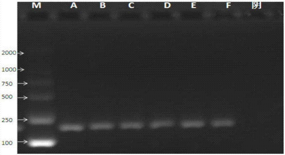 Kit for detecting pneumococcus 10A serotype