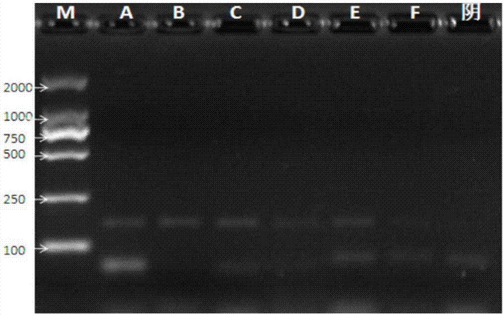 Kit for detecting pneumococcus 10A serotype