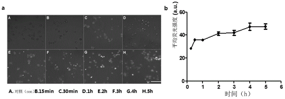 Hydroxyl acetylated curcumin and application thereof in preparation of ultrasonic sensitive agent for treating atherosclerosis