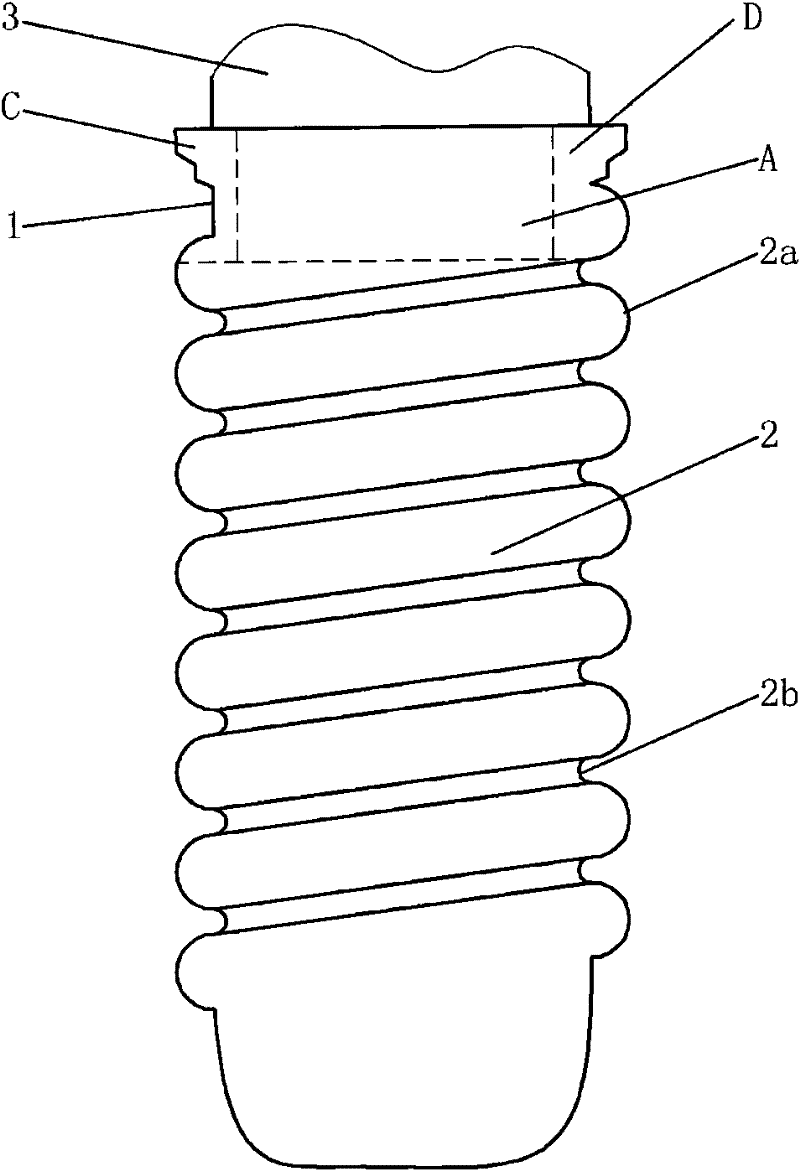 An intraosseous dental implant resistant to fretting damage