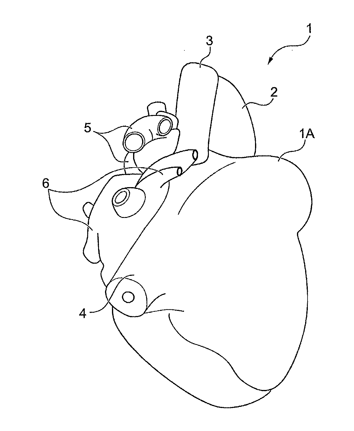 Method of producing organ model, mold for producing organ model, and organ model