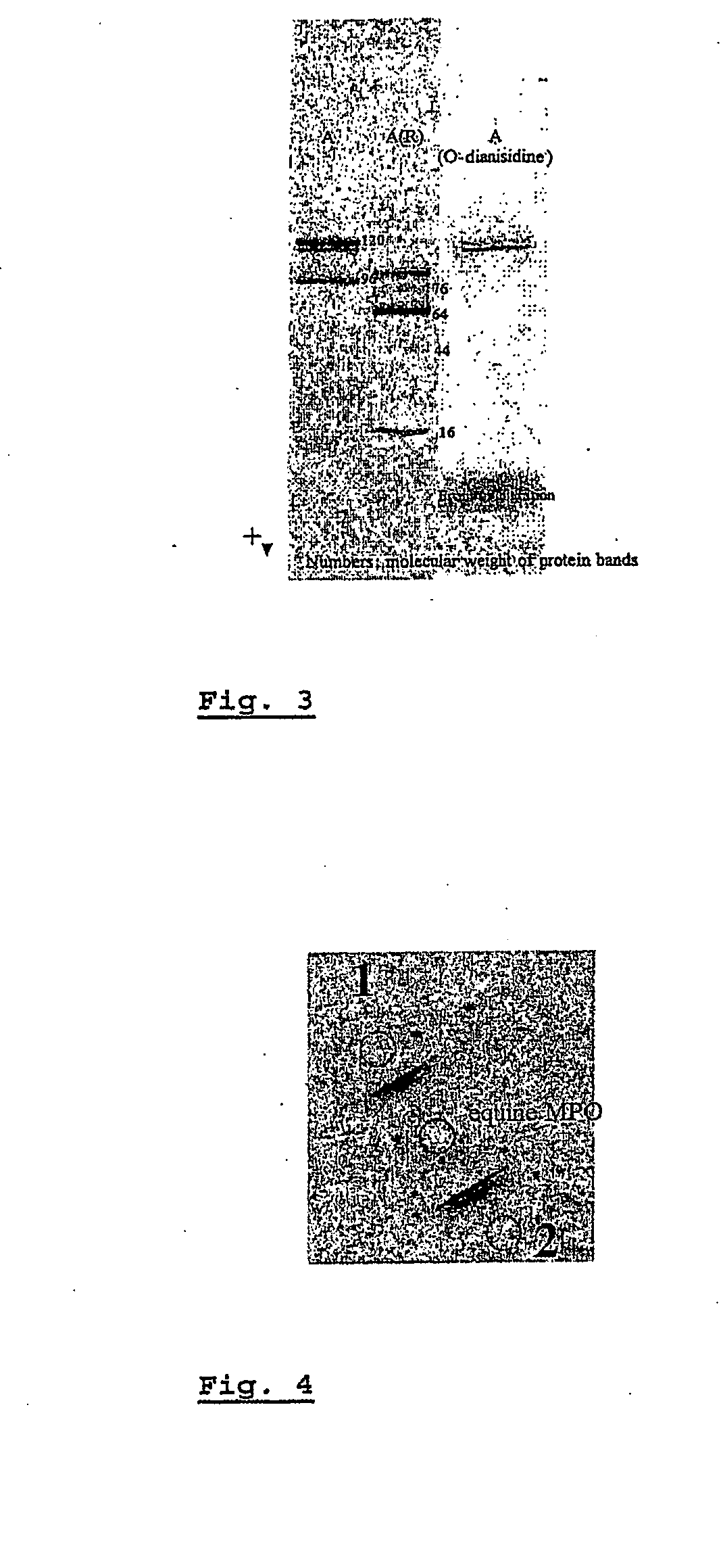 Method and Kit for the Measurement of Neutrophil Cell Activation