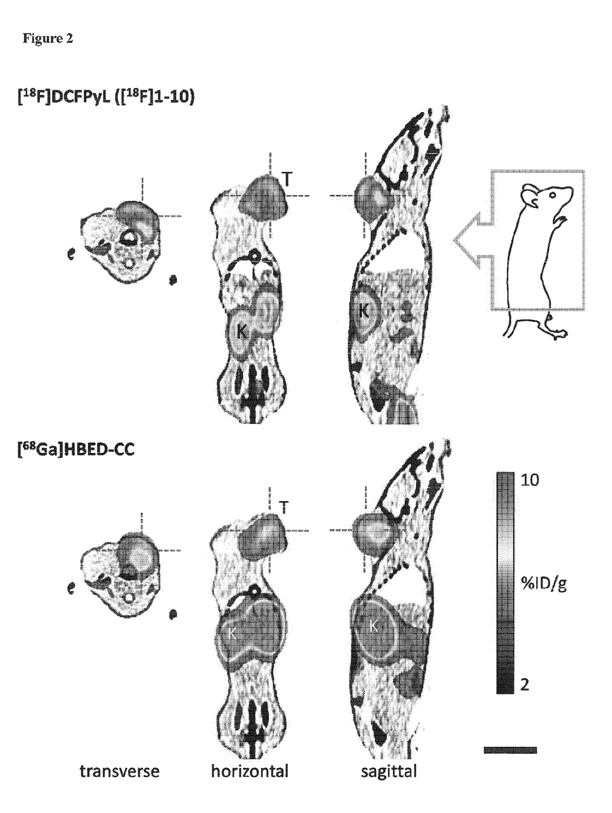 Novel method for the production of 18F-labeled active esters and their application exemplified by the preparation of a PSMA-specific PET-tracer