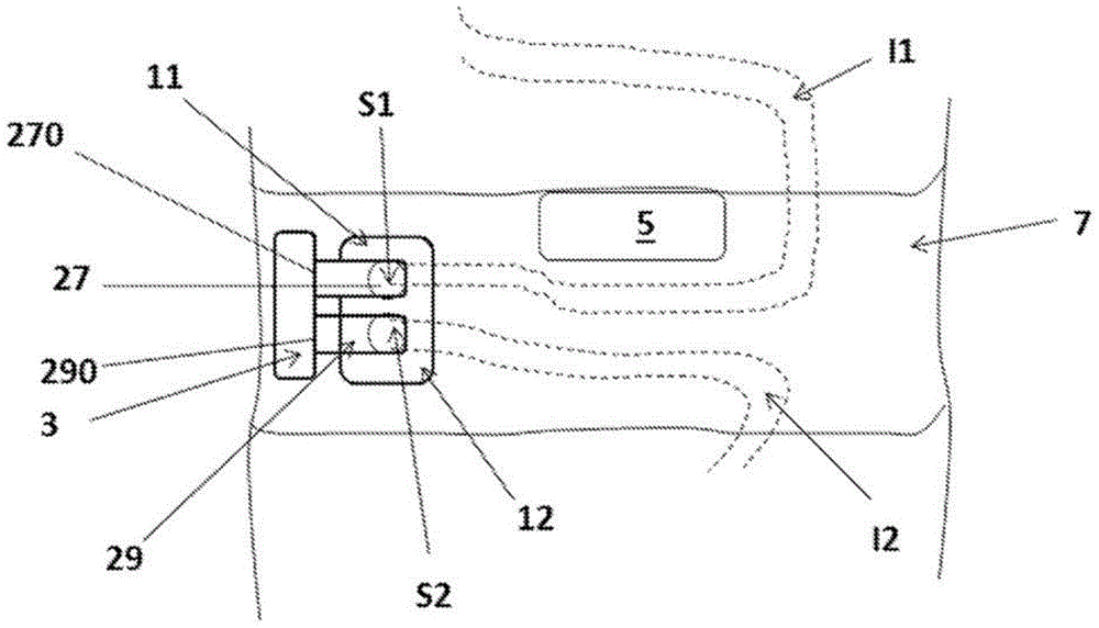 Device allowing an alimentary bolus flow between two stomas