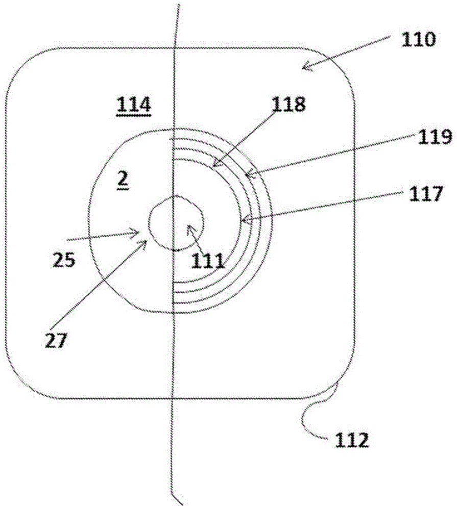 Device allowing an alimentary bolus flow between two stomas