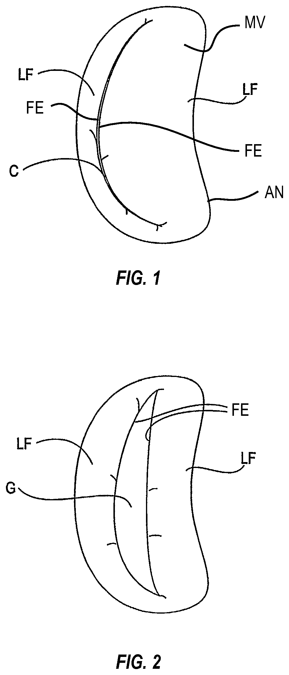 Tissue grasping devices and related methods