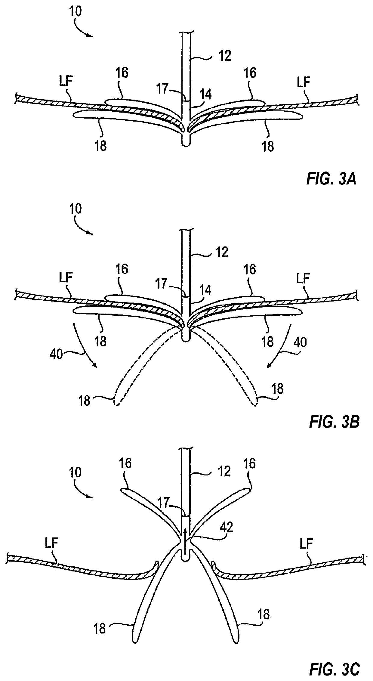 Tissue grasping devices and related methods