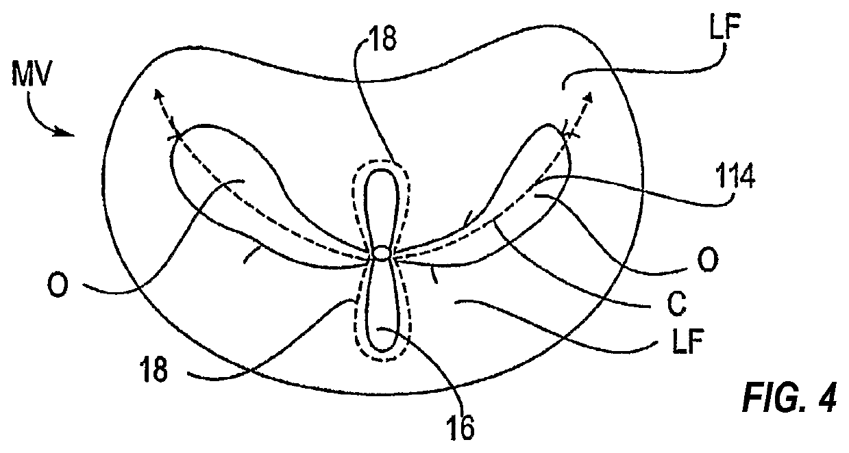 Tissue grasping devices and related methods