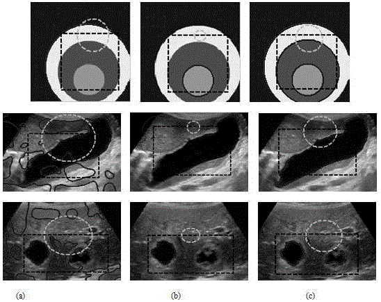 Medical ultrasonic image segmentation method with high precision and combining global and local regional information