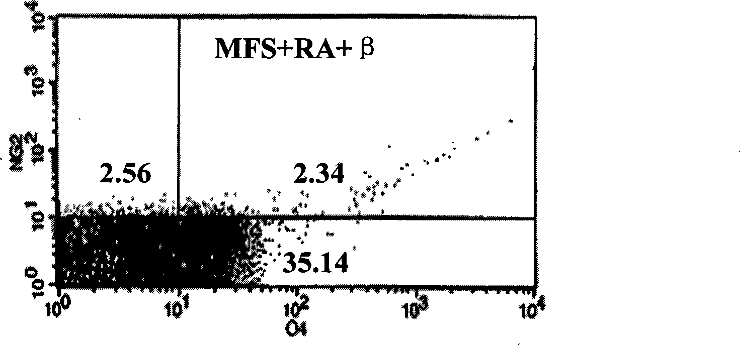Method for inducing human mesenchymal stem cells differentiation to oligoden drocyte