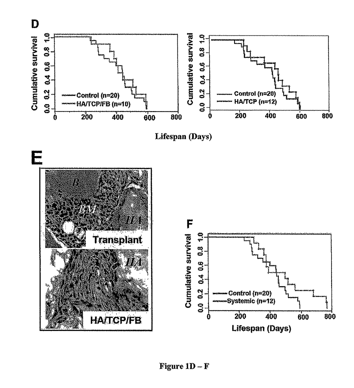 Method for treating an SLE-like autoimmune disease in a human subject consisting of administering stem cells from human exfoliated deciduous teeth (SHED) and erythropoietin (EPO) to said human subject