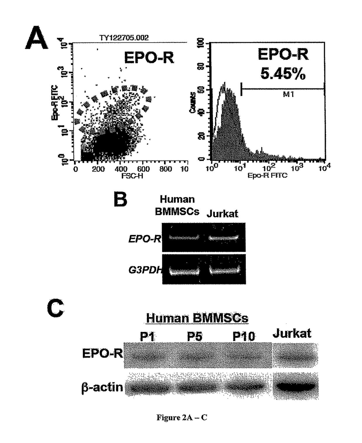 Method for treating an SLE-like autoimmune disease in a human subject consisting of administering stem cells from human exfoliated deciduous teeth (SHED) and erythropoietin (EPO) to said human subject