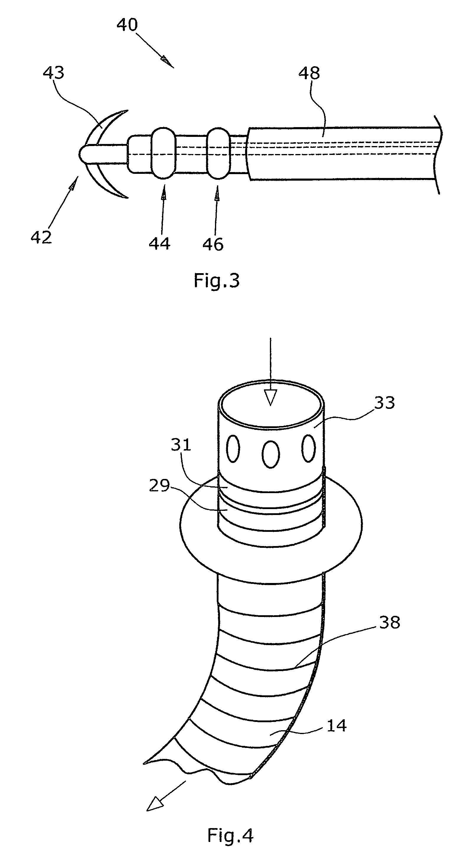 Artificial heart