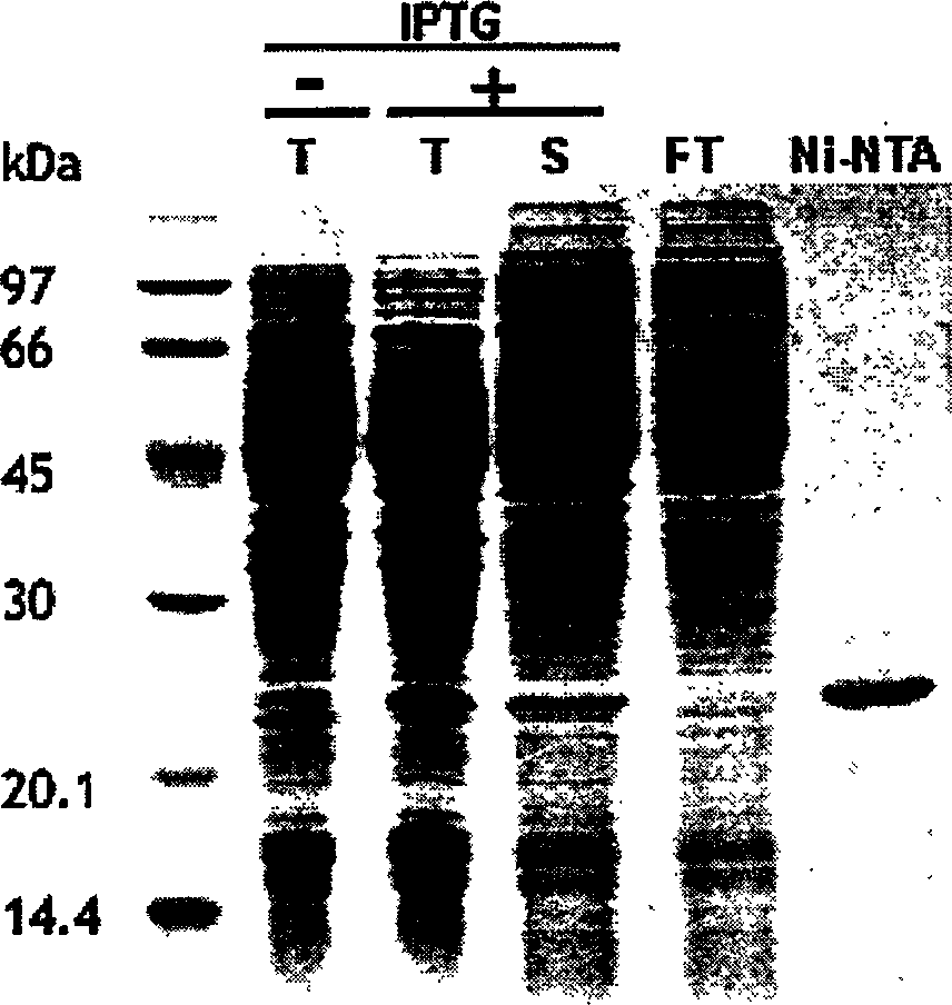 Prawn leukasmus rhabdovirus dUTPase gene and coded polypeptide thereof
