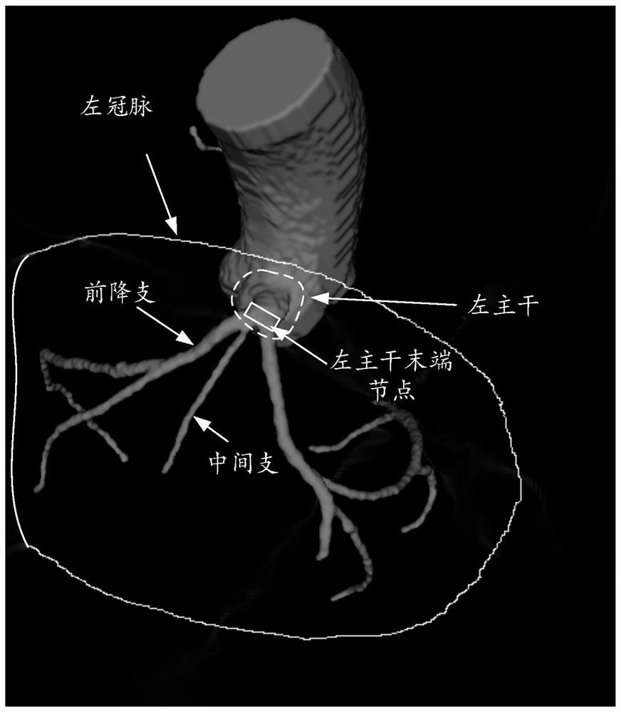 Coronary artery image classification method and device