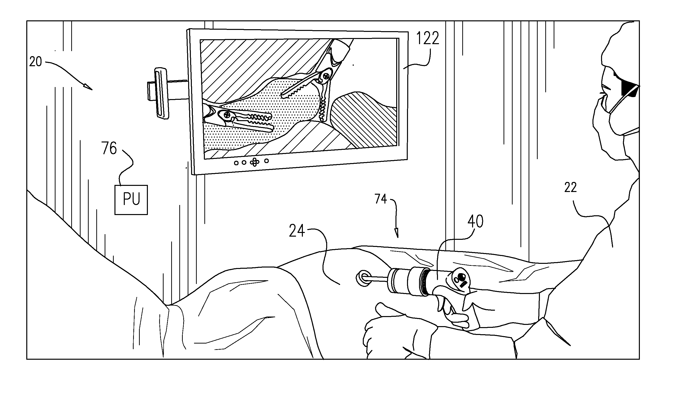 Robotic surgery