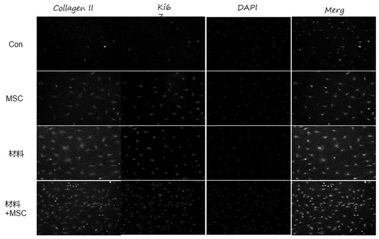 Preparation method of bi-crosslinking stem cell sphere hydrogel for osteoarthritis